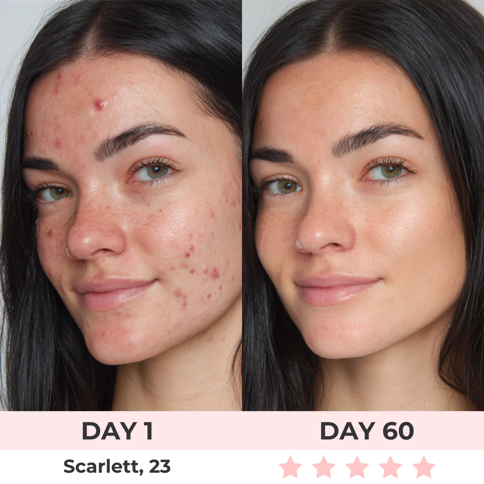 AureliaBay Facial Sculptor