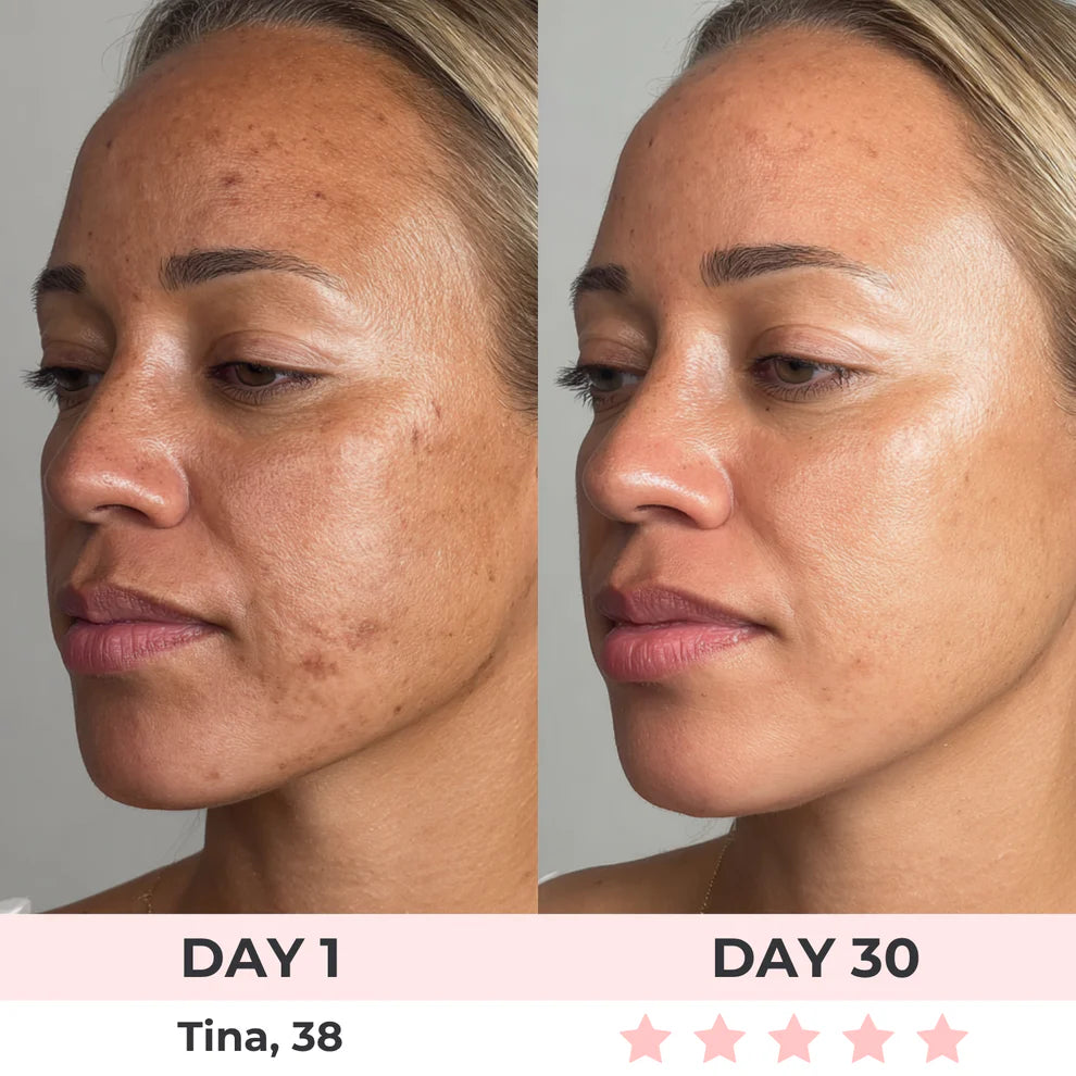 AureliaBay Facial Sculptor