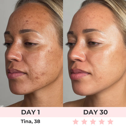 AureliaBay Facial Sculptor